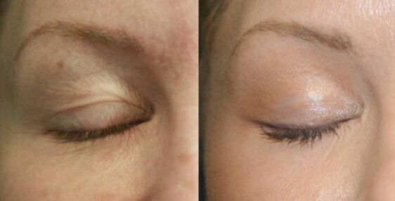 Take care of the areas near the eyes