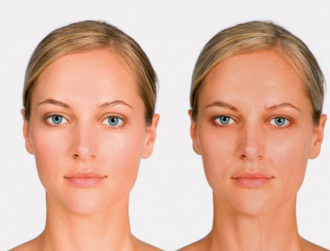 face the rejuvenation after and first